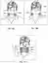 Fig. 10 - PERSONAL VENTILATION DEVICE AND METHOD FOR DELIVERING SANITIZED AIR TO PERSONAL BREATHING SPACE