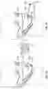 Fig. 19 - SEE-THROUGH FACE MASK AND FILTRATION SYSTEM FOR THE SAME