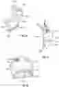 Fig. 20 - SEE-THROUGH FACE MASK AND FILTRATION SYSTEM FOR THE SAME