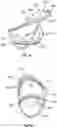 Fig. 21 - SEE-THROUGH FACE MASK AND FILTRATION SYSTEM FOR THE SAME