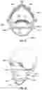 Fig. 22 - SEE-THROUGH FACE MASK AND FILTRATION SYSTEM FOR THE SAME