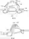 Fig. 24 - SEE-THROUGH FACE MASK AND FILTRATION SYSTEM FOR THE SAME