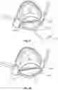 Fig. 25 - SEE-THROUGH FACE MASK AND FILTRATION SYSTEM FOR THE SAME