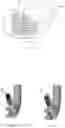 Fig. 18 - Golf club