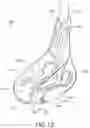 Fig. 14 - Game Stick