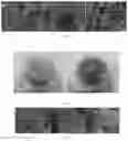 Fig. 03 - Starch-based adsorbent with nanopores and preparation method thereof