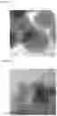 Fig. 06 - Catalyst for hydrogenation reaction and method for producing same