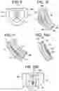 Fig. 10 - Microfluidic system, device and method