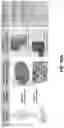 Fig. 12 - Isolation of Different Extracellular Vesicle (EV) Subpopulations