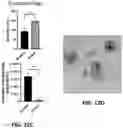 Fig. 17 - Isolation of Different Extracellular Vesicle (EV) Subpopulations