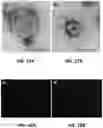 Fig. 25 - Isolation of Different Extracellular Vesicle (EV) Subpopulations