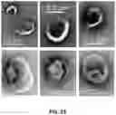 Fig. 29 - Isolation of Different Extracellular Vesicle (EV) Subpopulations