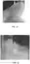 Fig. 16 - Cyanate ester kit for a thermally stable object