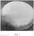 Fig. 02 - Punch Head, Punch, Shaping Apparatus, Container Making Machine, Shaping Method, and Bottom Blank and Container Formed Therefrom