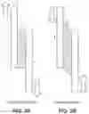 Fig. 03 - Dual shell dental appliance and material constructions