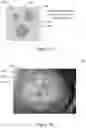 Fig. 02 - SEED AUTHENTICATION AND/OR GERMINATION ENHANCEMENT WITH THE CREATION OF MICROSTRUCTURES