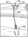 Fig. 01 - Method and apparatus for installing a boat fender