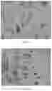 Fig. 02 - Ketamine pamoate and use thereof