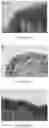 Fig. 35 - Ketamine pamoate and use thereof
