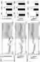 Fig. 15 - CB1R RECEPTOR BLOCKERS WITH ACYCLIC BACKBONES