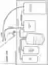 Fig. 17 - Methods and Devices for the Enrichment of Immunoglobulin from Blood