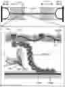 Fig. 01 - METHODS AND COMPOSITIONS FOR RAPIDLY REPLACING CARDIAC MYOSIN BINDING PROTEIN-C IN SARCOMERES