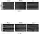 Fig. 02 - Recombinant adeno associated virus encoding clarin-1 and uses thereof