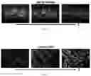 Fig. 03 - Recombinant adeno associated virus encoding clarin-1 and uses thereof