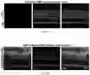 Fig. 04 - Recombinant adeno associated virus encoding clarin-1 and uses thereof