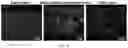 Fig. 05 - Recombinant adeno associated virus encoding clarin-1 and uses thereof
