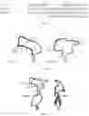 Fig. 10 - Recombinant adeno associated virus encoding clarin-1 and uses thereof