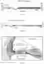 Fig. 11 - Recombinant adeno associated virus encoding clarin-1 and uses thereof