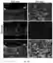Fig. 17 - Recombinant adeno associated virus encoding clarin-1 and uses thereof