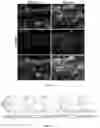 Fig. 18 - Recombinant adeno associated virus encoding clarin-1 and uses thereof