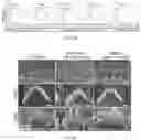 Fig. 19 - Recombinant adeno associated virus encoding clarin-1 and uses thereof