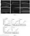 Fig. 21 - Recombinant adeno associated virus encoding clarin-1 and uses thereof