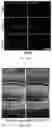 Fig. 24 - Recombinant adeno associated virus encoding clarin-1 and uses thereof