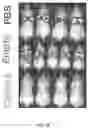 Fig. 15 - Activation of Antigen Presenting Cells and Methods for Using the Same
