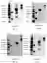 Fig. 03 - RAGE fusion proteins with improved stability and ligand binding affinity and uses thereof