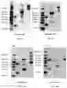 Fig. 04 - RAGE fusion proteins with improved stability and ligand binding affinity and uses thereof
