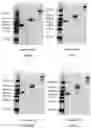 Fig. 05 - RAGE fusion proteins with improved stability and ligand binding affinity and uses thereof