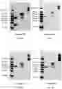 Fig. 06 - RAGE fusion proteins with improved stability and ligand binding affinity and uses thereof