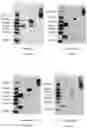 Fig. 07 - RAGE fusion proteins with improved stability and ligand binding affinity and uses thereof