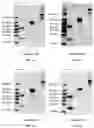 Fig. 09 - RAGE fusion proteins with improved stability and ligand binding affinity and uses thereof
