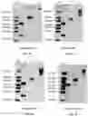 Fig. 10 - RAGE fusion proteins with improved stability and ligand binding affinity and uses thereof