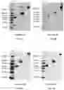 Fig. 12 - RAGE fusion proteins with improved stability and ligand binding affinity and uses thereof