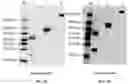 Fig. 13 - RAGE fusion proteins with improved stability and ligand binding affinity and uses thereof