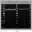 Fig. 19 - RAGE fusion proteins with improved stability and ligand binding affinity and uses thereof