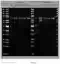 Fig. 20 - RAGE fusion proteins with improved stability and ligand binding affinity and uses thereof