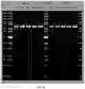 Fig. 21 - RAGE fusion proteins with improved stability and ligand binding affinity and uses thereof